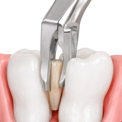 Extractor dental de acero inoxidable extrayendo una raíz dental