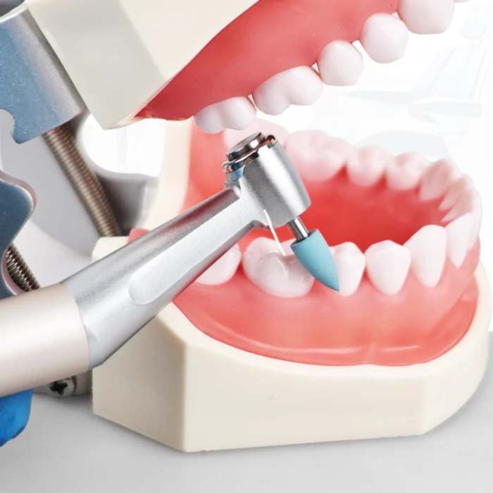 Kit de Pulido y Acabado para Resina – 12 Piezas (Baja Velocidad)